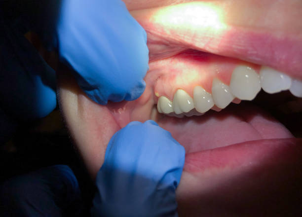 Best Emergency Dental Care for Trauma or Injury in Roscoe, IL